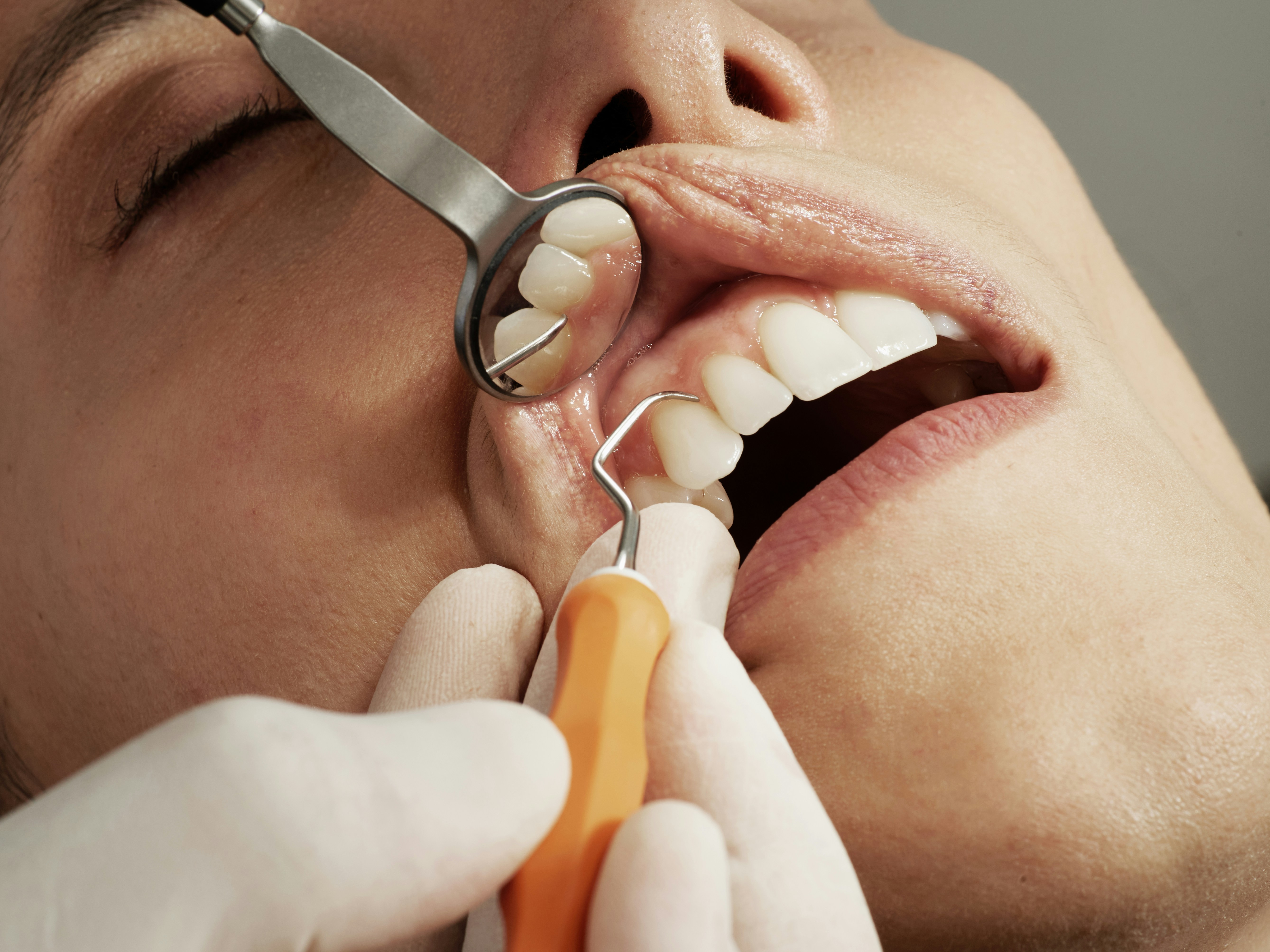 Dental team focused on patient care